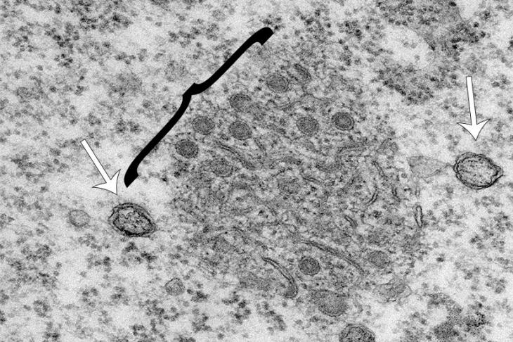 Electron micrograph of the two replication organelle structures. White arrows indicate double membrane vesicles and the black bracket encompasses the small circular spherules which protrude from the zippered endoplasmic reticulum (ER) that appear as tubular shapes.